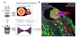 Working principle of E2E-BPF microscopy.