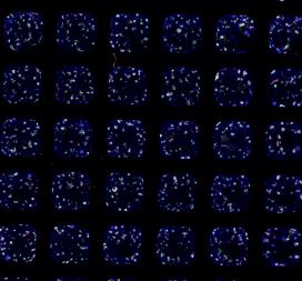Kidney Organoids Generated By Robots