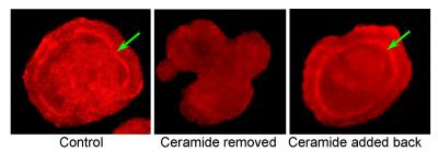 Lipid Plays Big Role in Embryonic Development