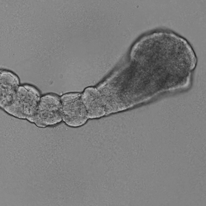 Time-lapse image of repetitive somite formation