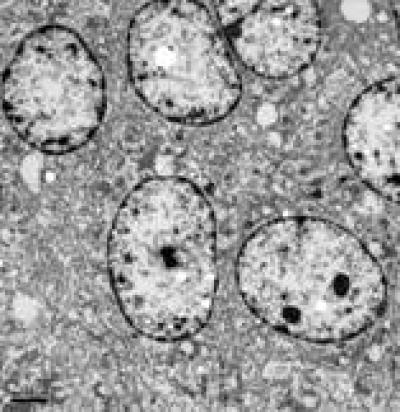 Swollen Mitochondria 