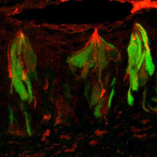 Sucrase Enzyme Localized to Taste Cells