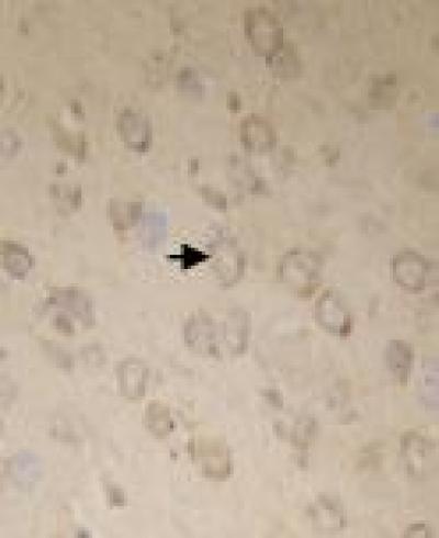 Bax Protein Expression