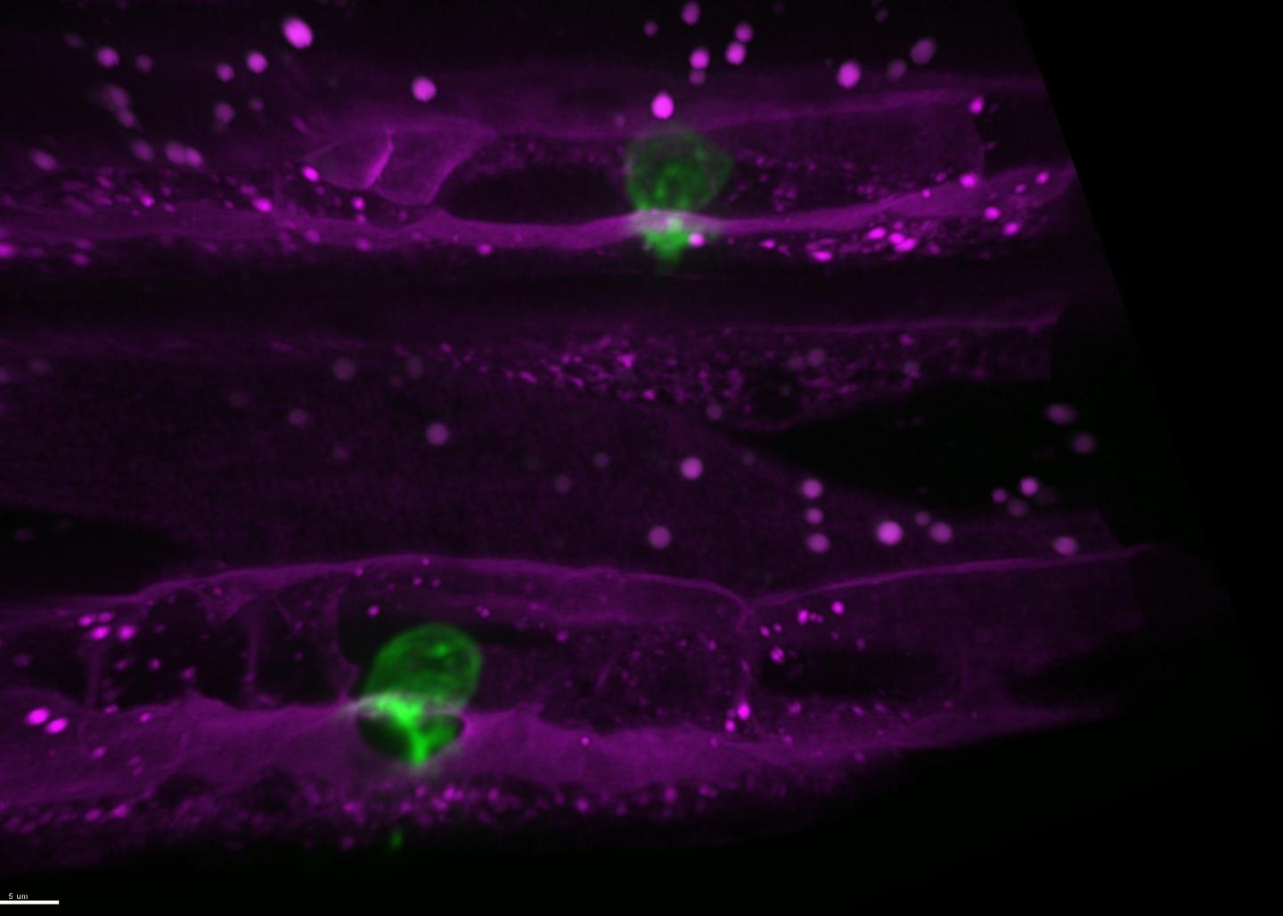 Cell Invasion in <em>C. elegans</em> Worms Mimics What Happens in Tumors
