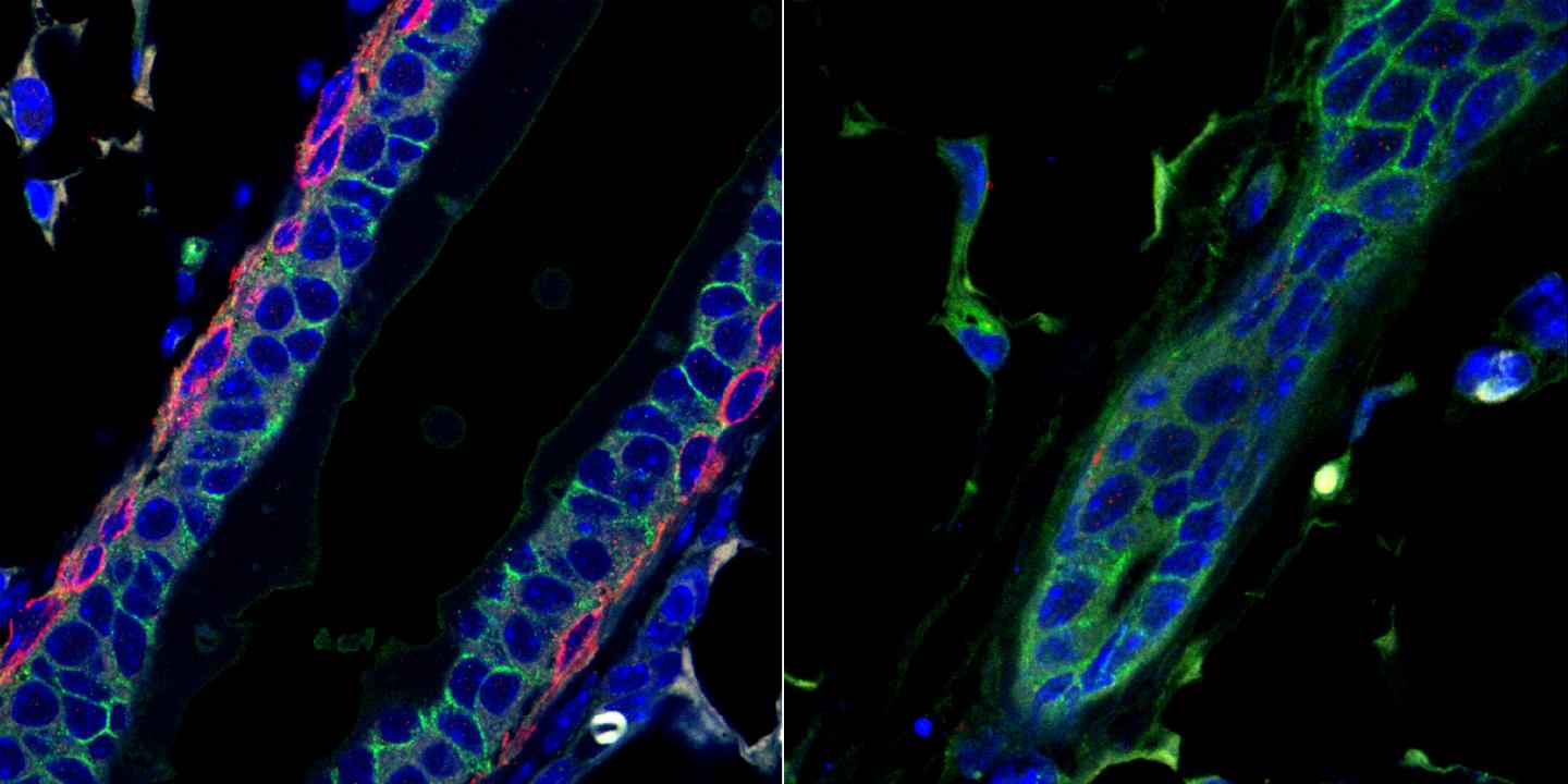 Development of the Mammary Gland during Puberty and Cancer