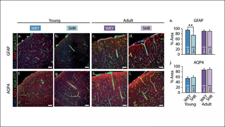 Fluorescent-Marked Astrocyte Distribution