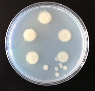 A Small Difference Led to a Big Discovery