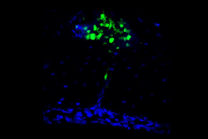 B cell migrating through bone channel