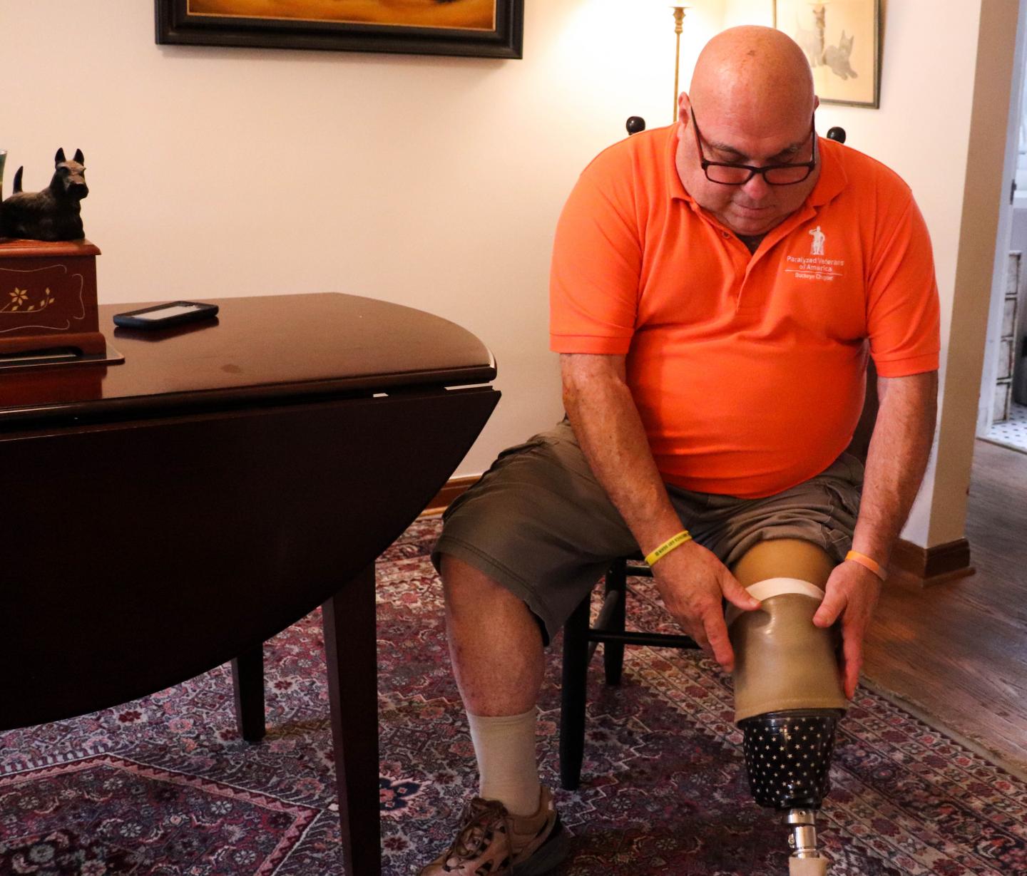 Nerve Reassignment Surgery At Time of Amputation Drastically Reduces Pain in Amputees