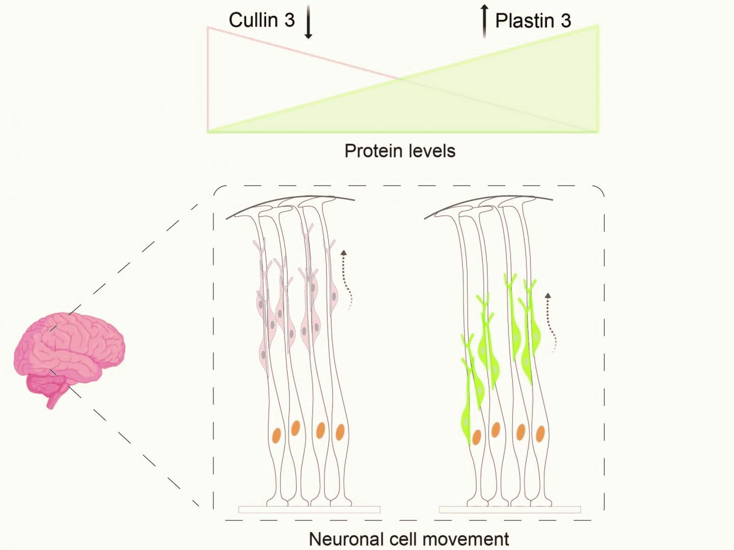 Defective Cullin 3 gene leads to accumulation of Plastin 3 protein