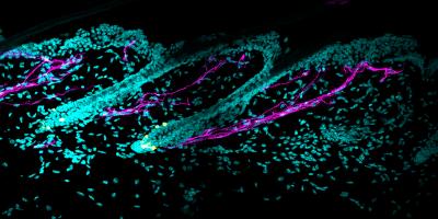 Sympathetic innervation around melanocyte stem cells