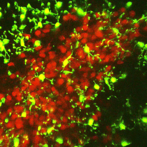 Microglia and CRH Neurons in PVN