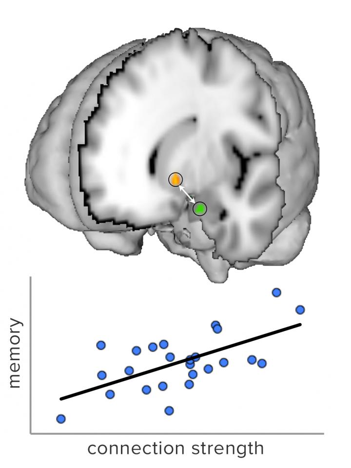 Reward-Seeking Behavior in the Teen Brain