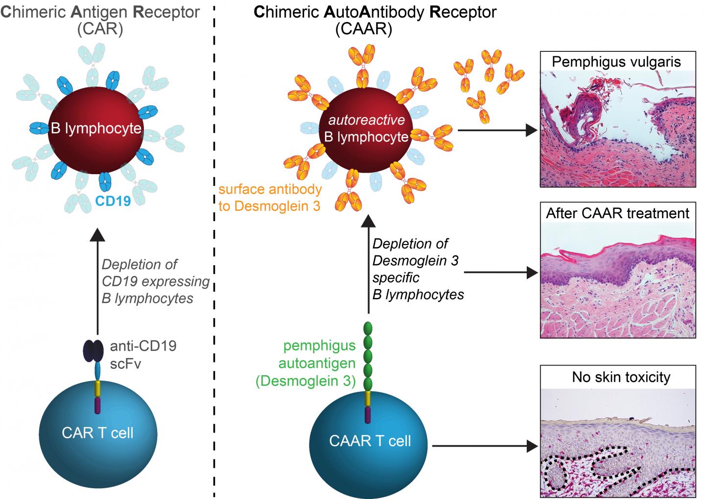 CAAR: Treating Autoimmune Disease Without Harming Normal Immunity