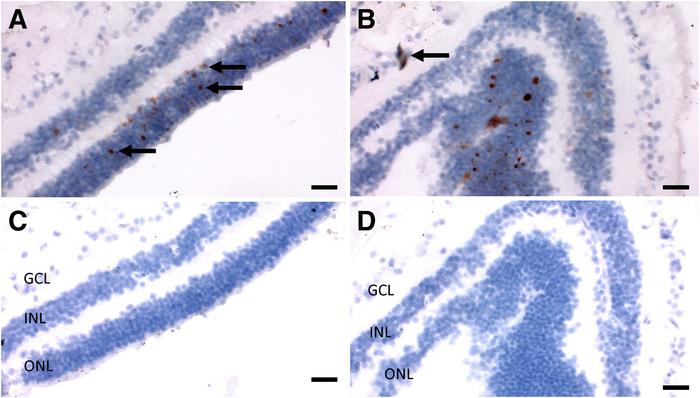 Detection of severe acute respiratory syndrome coronavirus 2 (SARS-CoV-2) spike RNA by in situ hybridization (ISH) in the retina