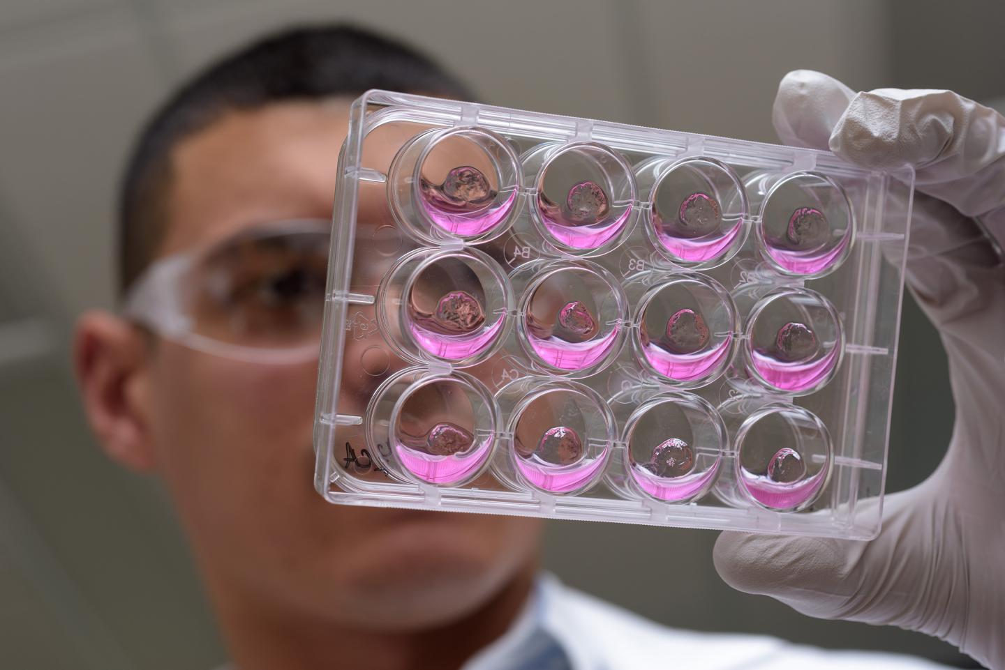 Hydrogel Matrix Materials