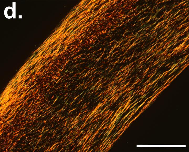 Biological Blood Vessel Grafts with No Living Parts Perform Well in Primates (3 of 7)