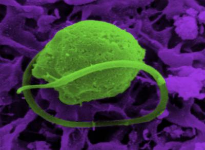 Electron Micrograph of <i>Bigelowiella natans</i>