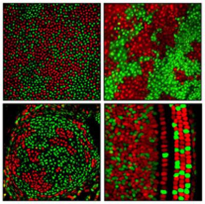 Various Patterns of X Chromosome Silencing