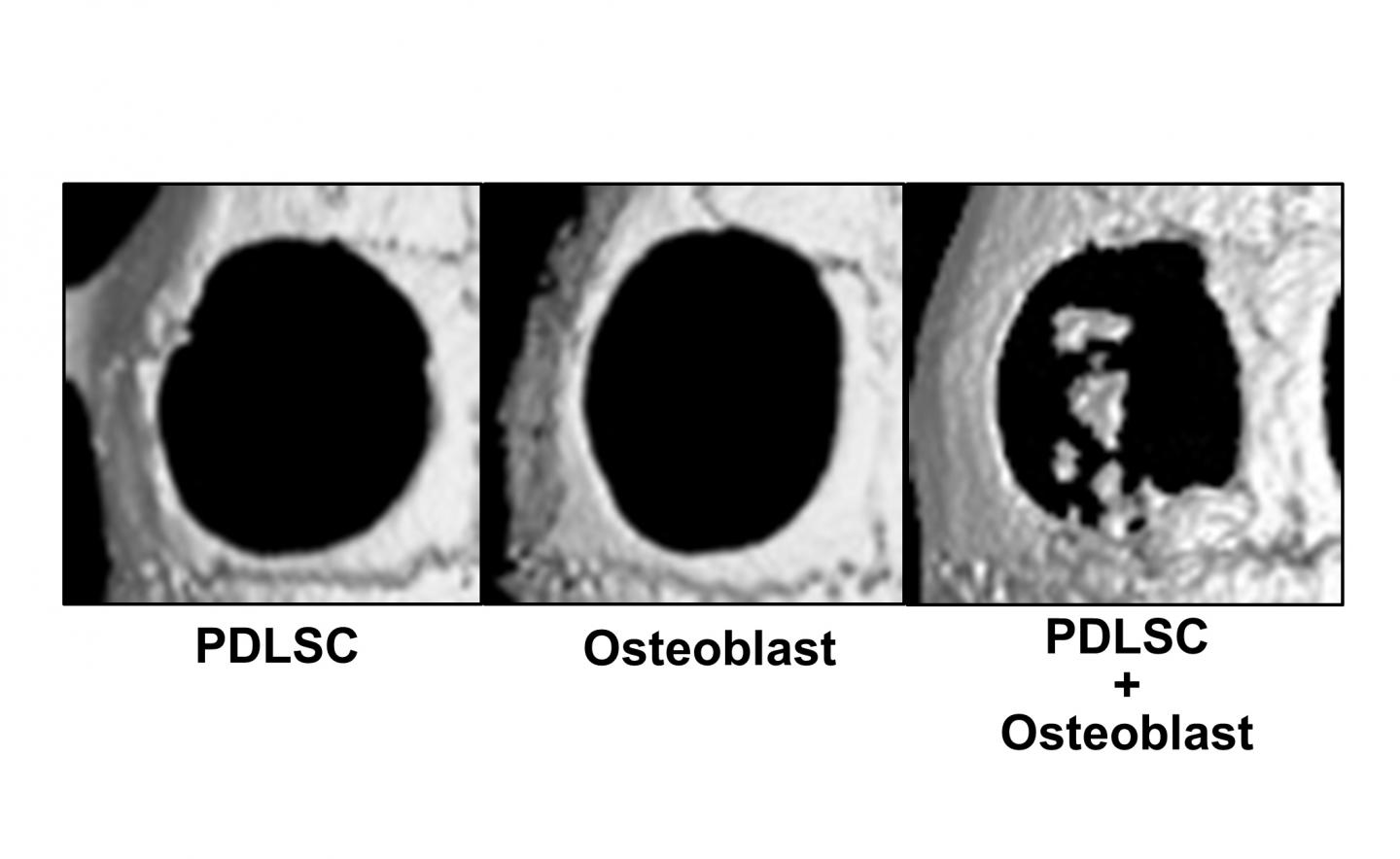 Bone Regeneration by Cell-Transferred Amnion