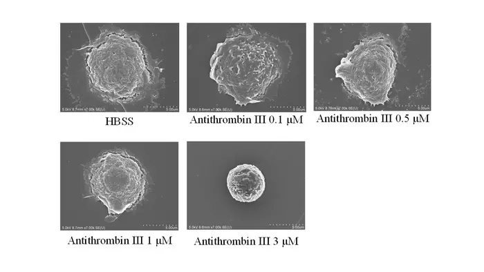 Morphological changes in human neutrophils caused by antithrombin (scanning electron micrograph)