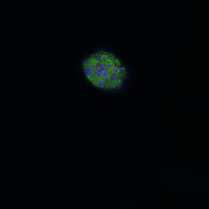 Fluorescent microscopic picture of 3D model meningioma