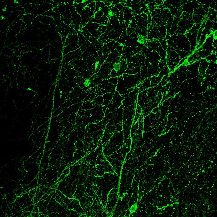 CRF-producing neurons