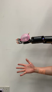 Teleoperating prosthetic hand to grab balloon