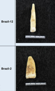 Ancient Teeth – Northeast Brazil Samples