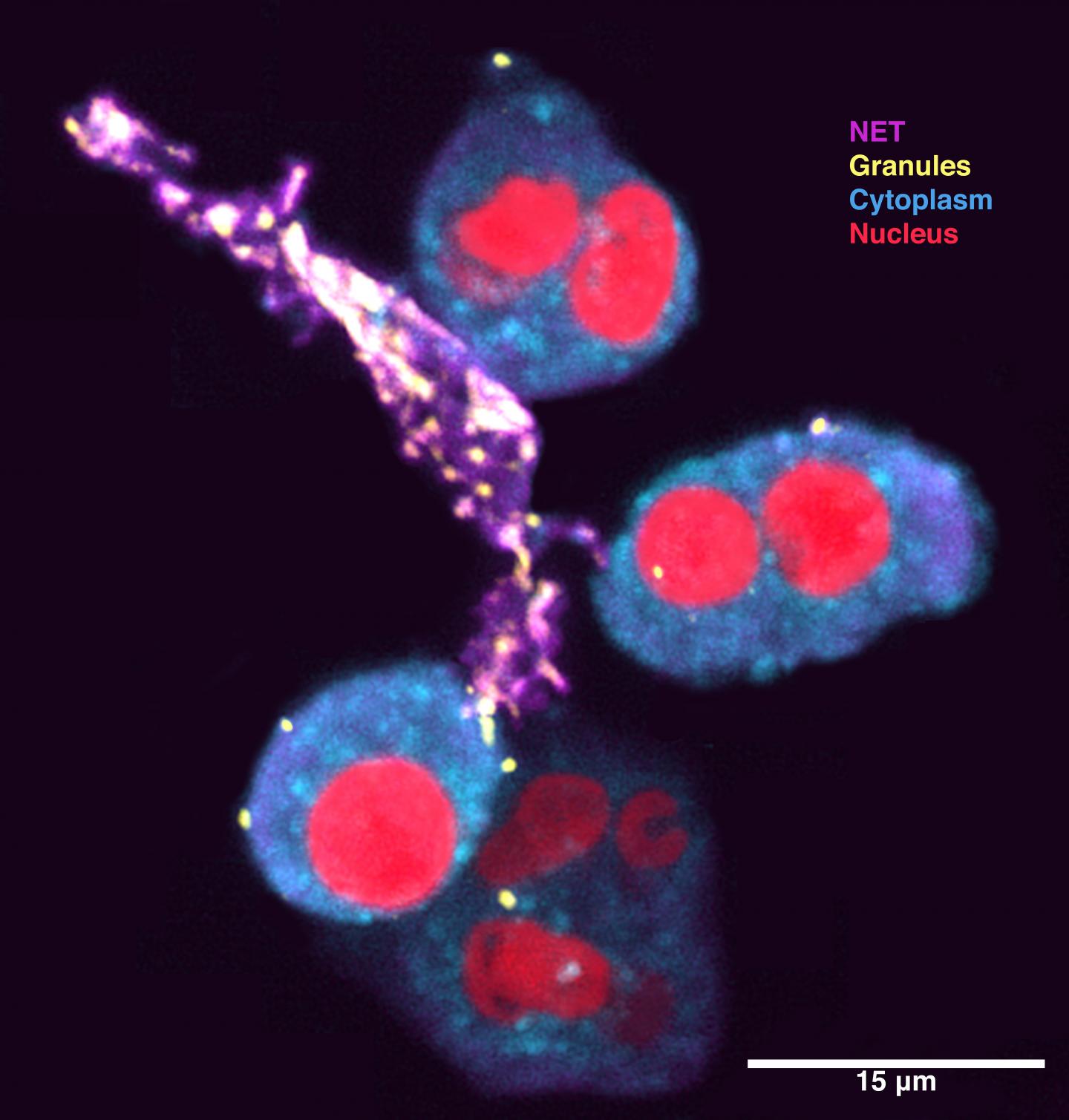 Mycobacterium tuberculosis