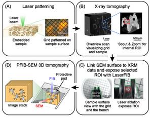 Workflow for bone imaging and characterization