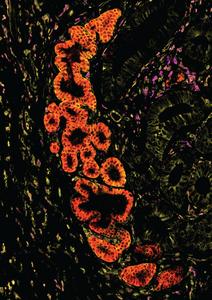 Human Intestinal Tract in IBD (5)