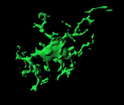 Microglia Reconstruction