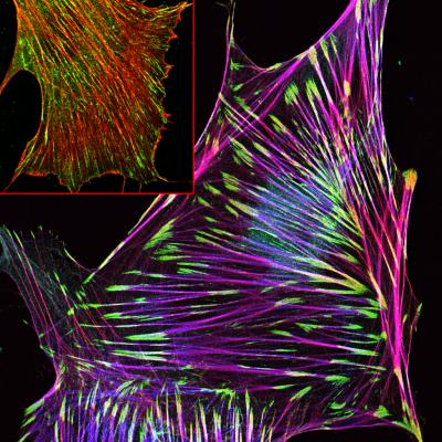 The Fibroblast Muscles