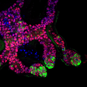 Human Kidney Ureteric Bud Organoids