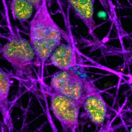 DNA Damage Repair in Neurons
