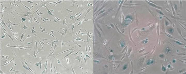 Markers for Cellular Senescence