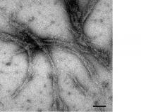 Amyloid Fibril Formations