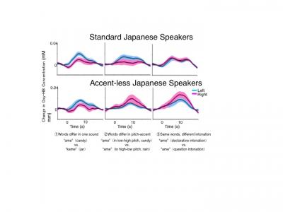 Graph Showing Brain Activity in the Right and Left Hemispheres