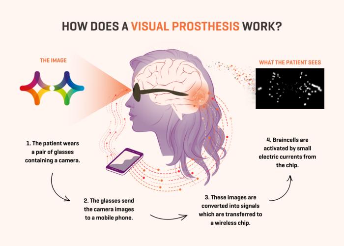 Visual Prosthesis simulator offers a glimpse into the future