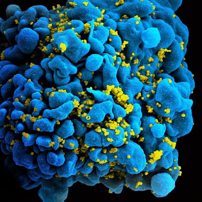 HIV-infected T-cell