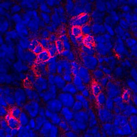 CD8+ Cells, UC San Diego School of Medicine
