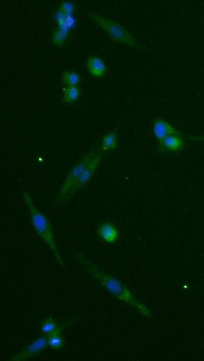 Cells Treated with 27HC