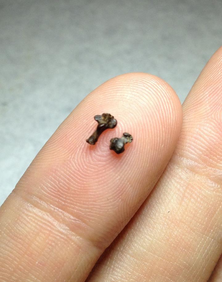 Stephen Chester Holds the Tiny Ankle Bones of <i>Purgatorius</i>