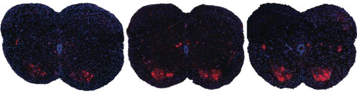 Research Reveals Underlying Pathology of Spinal Muscular Atrophy Disease