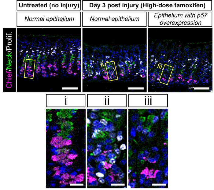 Control vs. injury labeled