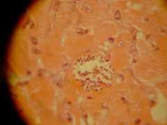 Resveratrol Reverses Heart Damage in Mice with Chagas Disease