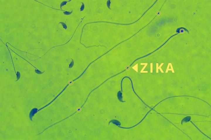 Zika-infected Mouse Sperm