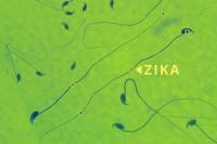 Zika-infected Mouse Sperm