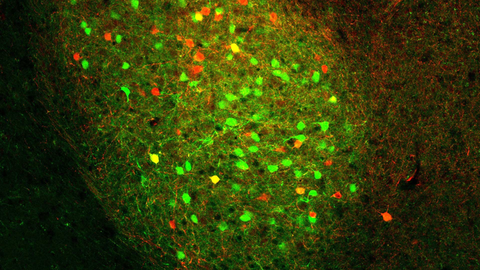 The basolateral amygdala